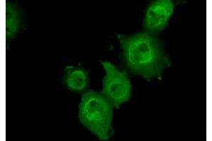 Anti-MAPK11 mouse monoclonal antibody (ABIN2453276) immunofluorescent staining of COS7 cells transiently transfected by pCMV6-ENTRY MAPK11 (RC206583). (MAPK11 抗体)