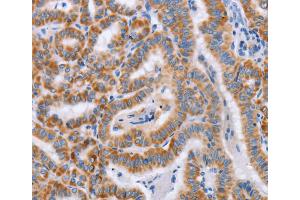 Immunohistochemistry (IHC) image for anti-Bone Marrow Stromal Cell Antigen 1 (BST1) antibody (ABIN2434360) (BST1 抗体)