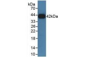 Western blot analysis of recombinant Rat GHR. (Growth Hormone Receptor 抗体  (AA 353-588))