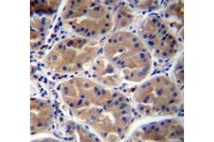 RAB27B antibody immunohistochemistry analysis in formalin fixed and paraffin embedded human stomach tissue. (RAB27B 抗体  (AA 121-150))