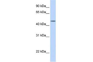 TBL2 antibody used at 1 ug/ml to detect target protein. (TBL2 抗体)