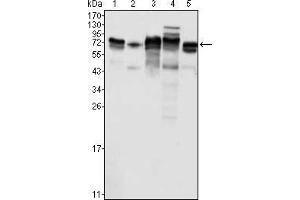 Western blot analysis using Metadherin mouse mAb against K562 (1), SKBR-3 (2), T47D (3), Hela (4) and MCF-7 (5) cell lysate. (MTDH 抗体)