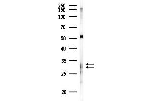 anti-Aquaporin 9 (AQP9) (Internal Region) antibody