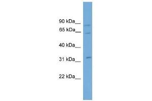 CAPN11 antibody used at 0. (CAPN11 抗体  (N-Term))