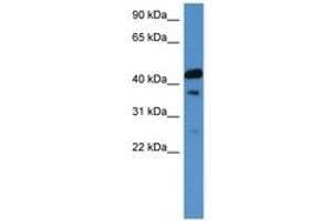 Image no. 1 for anti-Calcitonin Receptor (CALCR) (C-Term) antibody (ABIN6746629) (Calcitonin Receptor 抗体  (C-Term))