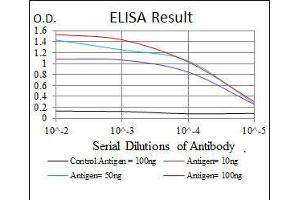 Black line: Control Antigen (100 ng), Purple line: Antigen(10 ng), Blue line: Antigen (50 ng), Red line: Antigen (100 ng), (SKP1 抗体)