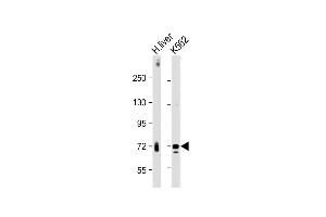All lanes : Anti-ACOX1 Antibody at 1:4000 dilution Lane 1: Human liver lysate Lane 2: K562 whole cell lysate Lysates/proteins at 20 μg per lane. (ACOX1 抗体)