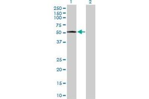 Western Blot analysis of HMGCS2 expression in transfected 293T cell line by HMGCS2 MaxPab polyclonal antibody. (HMGCS2 抗体  (AA 1-508))