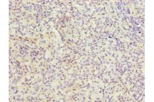 Immunohistochemistry of paraffin-embedded human spleen tissue using ABIN7156460 at dilution of 1:100 (ITGAL 抗体  (AA 201-500))