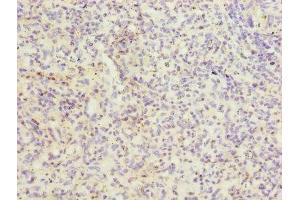 Immunohistochemistry of paraffin-embedded human spleen tissue using ABIN7156460 at dilution of 1:100 (ITGAL 抗体  (AA 201-500))