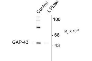 Image no. 2 for anti-Growth Associated Protein 43 (GAP43) (pSer41) antibody (ABIN227321) (GAP43 抗体  (pSer41))