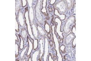 Immunohistochemical staining of human kidney with ACSM1 polyclonal antibody  shows strong cytoplasmic positivity in cells in tubules at 1:20-1:50 dilution. (ACSM1 抗体)