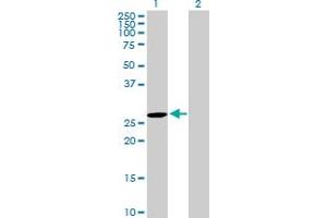 Western Blot analysis of DUPD1 expression in transfected 293T cell line by DUPD1 MaxPab polyclonal antibody. (DUPD1 抗体  (AA 1-220))