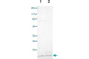Western blot analysis of Lane 1: Human cell line RT-4, Lane 2: Human cell line U-251MG sp with TIMM9 polyclonal antibody  at 1:100-1:250 dilution. (TIMM9 抗体)