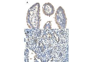 Immunohistochemical staining (Formalin-fixed paraffin-embedded sections) of (A) human intestine and (B) human lung tissues with KRT2 polyclonal antibody . (Keratin 2 抗体  (AA 351-400))