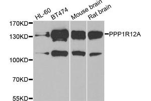 Western blot analysis of extracts of various cell lines, using PPP1R12A antibody (ABIN5974045) at 1/1000 dilution. (PPP1R12A 抗体)