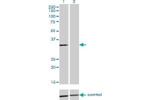 Western blot analysis of ANXA3 over-expressed 293 cell line, cotransfected with ANXA3 Validated Chimera RNAi (Lane 2) or non-transfected control (Lane 1). (Annexin A3 抗体  (AA 1-323))