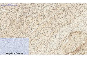 Immunohistochemical analysis of paraffin-embedded human uterus tissue. (DNMT3B 抗体  (AA 1-80))