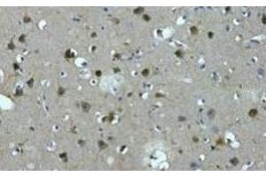 Immunohistochemistry of paraffin-embedded Human brain tissue using MAP2 Monoclonal Antibody at dilution of 1:200. (MAP2 抗体)
