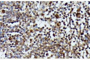 Immunohistochemistry of paraffin-embedded Human appendix using MAP3K3 Polyclonal Antibody at dilution of 1:100 (40x lens). (MAP3K3 抗体)