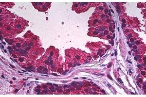 Human Prostate, Epithelium: Formalin-Fixed, Paraffin-Embedded (FFPE) (PDE9A 抗体)