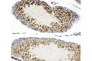 IHC-P: TIM-1 antibody testing of rat testis tissue (HAVCR1 抗体  (AA 289-307))