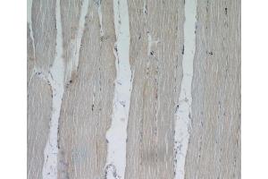 Immunohistochemistry (IHC) image for anti-Xin Actin-Binding Repeat Containing 2 (XIRP2) antibody (ABIN2906145) (XIRP2 抗体)