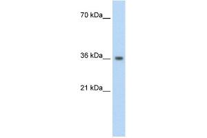 WB Suggested Anti-PHYHIP Antibody Titration:  1. (PHYHIP 抗体  (N-Term))