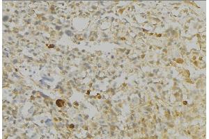 ABIN6276728 at 1/100 staining Human gastric tissue by IHC-P. (Monoamine Oxidase B 抗体  (Internal Region))