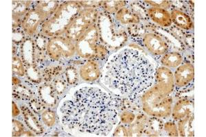 AP31060PU-N WRNIP1 antibody staining of paraffin embedded Human Kidney. (WRNIP1 抗体  (C-Term))