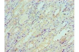 Immunohistochemistry of paraffin-embedded human kidney tissue using ABIN7148620 at dilution of 1:100 (SERPINA6 抗体  (AA 136-405))