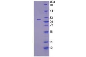 SDS-PAGE analysis of Human TNKS2 Protein. (TNKS2 蛋白)