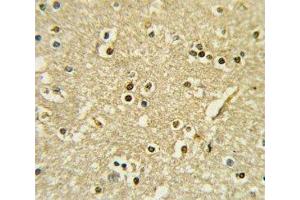 IHC analysis of FFPE human brain tissue stained with PAX6 antibody (PAX6 抗体  (AA 183-210))