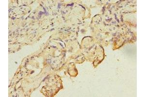 Immunohistochemistry of paraffin-embedded human placenta tissue using ABIN7146710 at dilution of 1:100