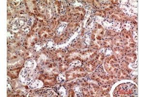 Immunohistochemistry (IHC) analysis of paraffin-embedded Human Kidney, antibody was diluted at 1:100. (M-CSF/CSF1 抗体  (Internal Region))