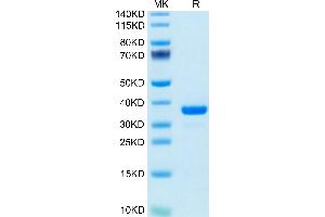 IGFBP7 Protein (AA 26-281) (His tag)