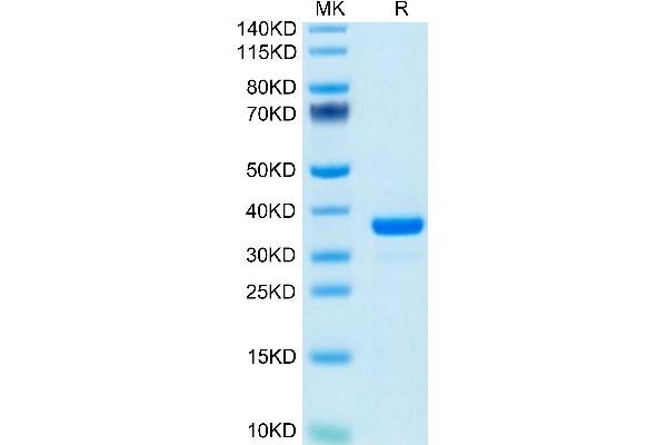 IGFBP7 Protein (AA 26-281) (His tag)