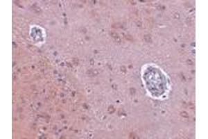 Immunohistochemistry of FAM120A in rat brain tissue with FAM120A antibody at 2.