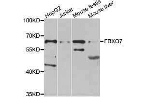 Western blot analysis of extracts of various cell lines, using FBXO7 antibody. (FBXO7 抗体)
