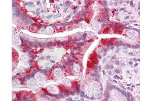 Anti-ALKBH3 antibody IHC of human small intestine. (ALKBH3 抗体  (AA 216-265))