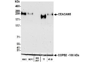 Western Blotting (WB) image for anti-Carcinoembryonic Antigen-Related Cell Adhesion Molecule 5 (CEACAM5) (AA 35-685) antibody (ABIN7453964) (Recombinant CEACAM5 抗体  (AA 35-685))