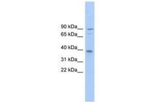 Image no. 1 for anti-Transmembrane Channel-Like 8 (TMC8) (AA 143-192) antibody (ABIN6745010) (TMC8 抗体  (AA 143-192))