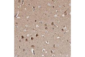 Immunohistochemical staining (Formalin-fixed paraffin-embedded sections) of human cerebral cortex with PRKACB polyclonal antibody  shows strong cytoplasmic positivity in neuronal cells. (PRKACB 抗体)