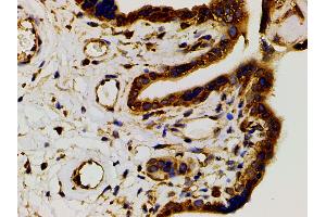Immunohistochemistry (IHC) image for anti-Phosphoinositide 3 Kinase, p85 alpha (PI3K p85a) (pTyr607) antibody (ABIN6256775)