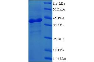 SDS-PAGE (SDS) image for Nicotinamide Nucleotide Adenylyltransferase 3 (NMNAT3) (AA 1-215), (Isoform 2) protein (His-SUMO Tag) (ABIN5711591) (NMNAT3 Protein (AA 1-215, Isoform 2) (His-SUMO Tag))