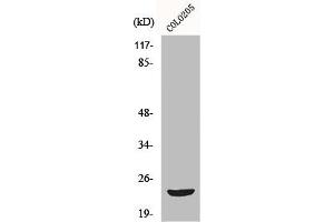 Western Blot analysis of COLO205 cells using Mob3B Polyclonal Antibody (MOBKL2B 抗体  (Internal Region))