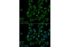 Immunofluorescence analysis of HeLa cells using PEX5 antibody (ABIN5973402). (PEX5 抗体)