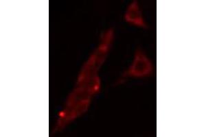 ABIN6268691 staining HeLa cells by IF/ICC. (TJP1 抗体)