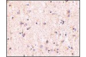 Immunohistochemistry of IRGM in human brain with this product at 5 μg/ml. (IRGM 抗体  (Center))