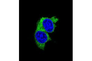 Confocal iunofluorescent analysis of P1 Antibody (Center) (ABIN655817 and ABIN2845241) with MDA-M cell followed by Alexa Fluor 488-conjugated goat anti-rabbit lgG (green). (MMP1 抗体  (AA 317-347))